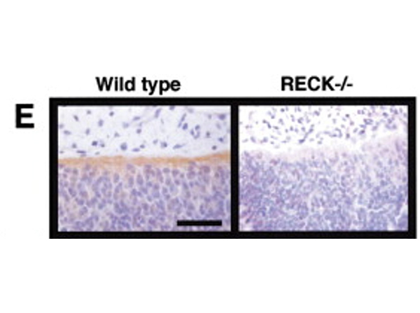 Immunohistochemistry using Collagen Type I